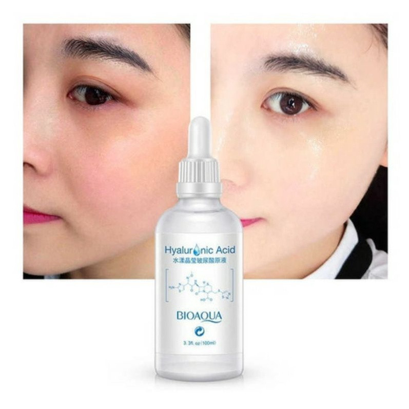 ACIDO HIALURONICO BIOAQUA - BIOTEZ